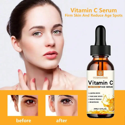 Vitamin C Whitening Facial Serum with Hyaluronic Acid - Dark Spot Remover, Anti-Aging Serum